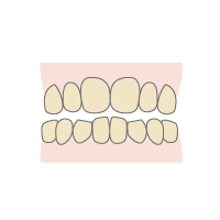 治療前の歯の色をチェック